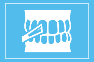 kids Dental Sealants powder springs